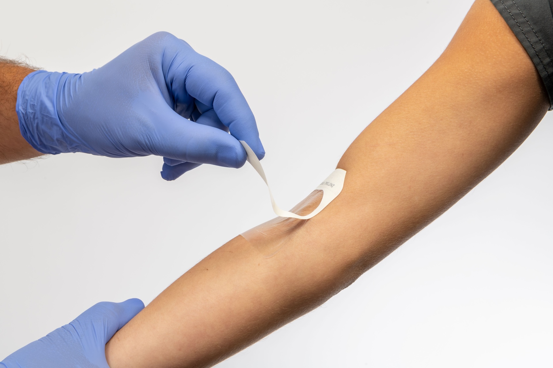 Pattern printed medical adhesives